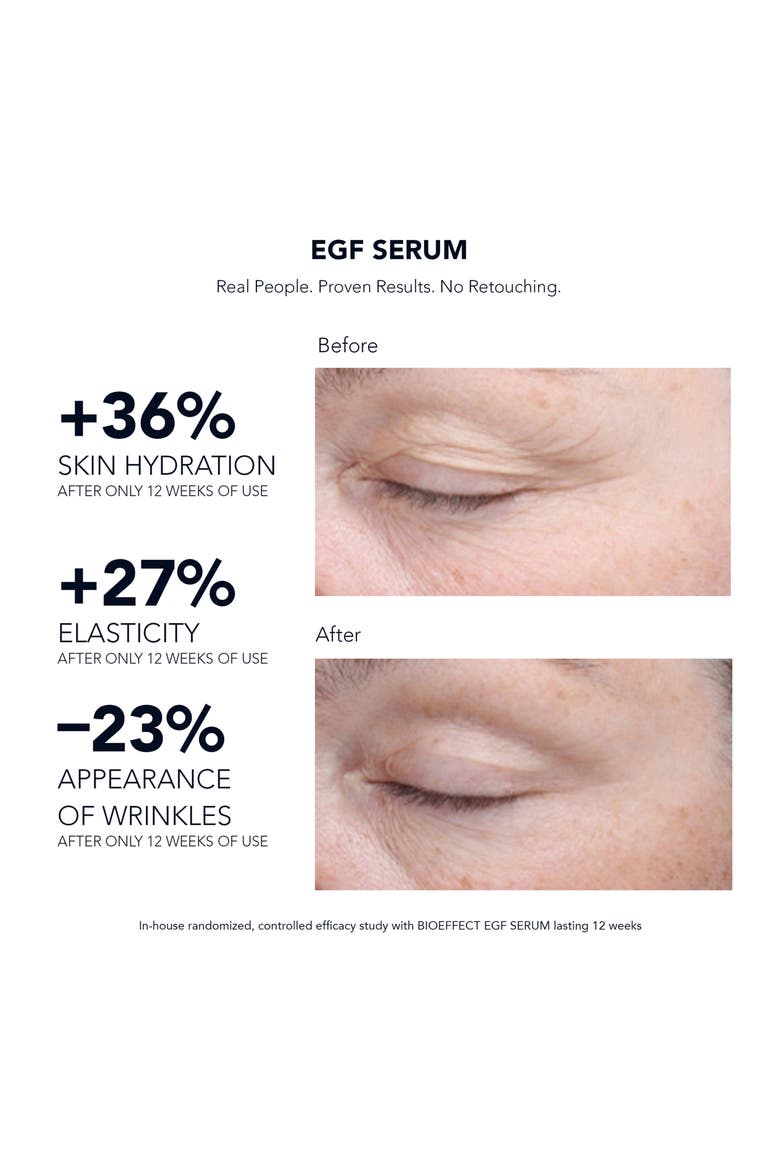 EGF Face Serum, Alternate, color, NO COLOR