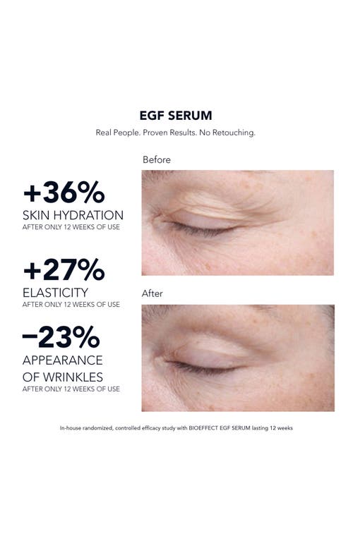 Bioeffect Egf Plumping And Firming Serum 15ml In No Color