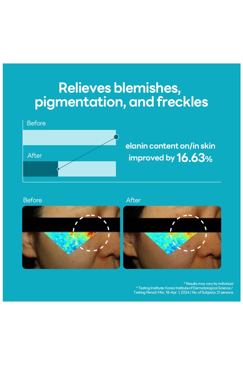 Madecassoside Blemish Repair Serum, Alternate, color, TURQUOISE/ AQUA