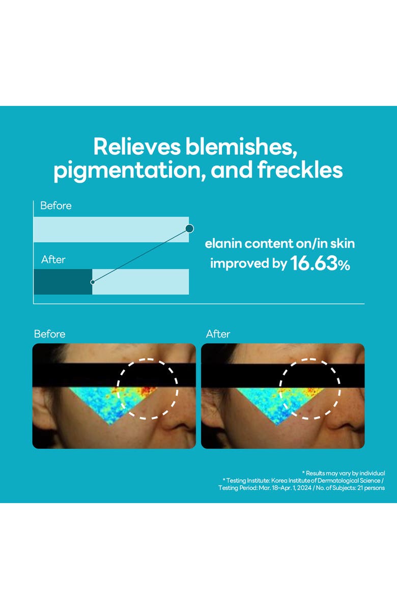 MEDIHEAL Madecassoside Blemish Repair Serum, Alternate, color, Turquoise/ Aqua