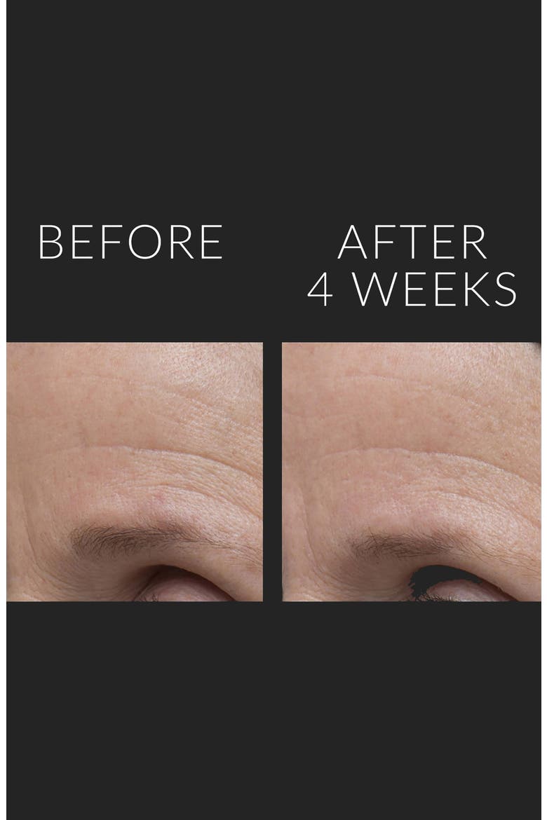DermalQuench Liquid Lift™ + Retinol Advanced Resurfacing Treatment, Alternate, color, NO COLOR