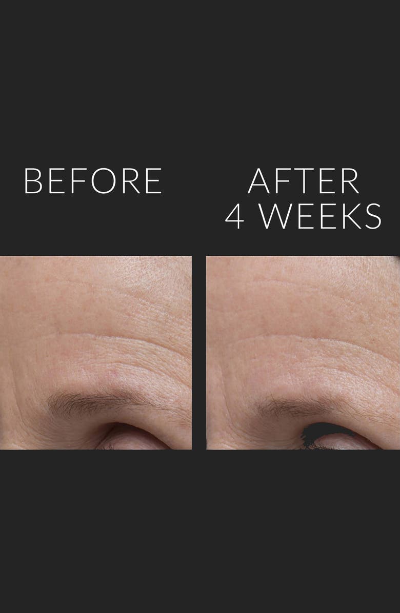 Kate Somerville<sup>®</sup> DermalQuench Liquid Lift<sup>™</sup> + Retinol Advanced Resurfacing Treatment, Alternate, color,