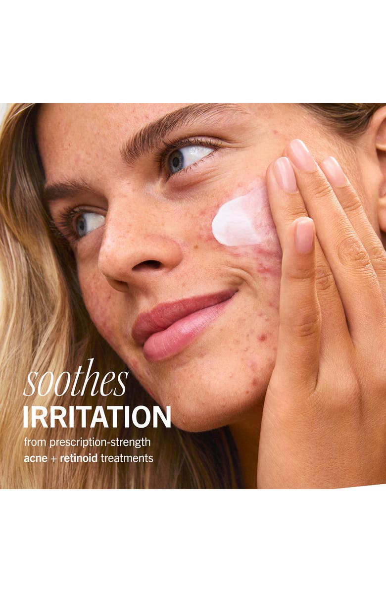 First Aid Beauty Ultra Repair Rescue Barrier Balm with Dimethicone, Alternate, color, 