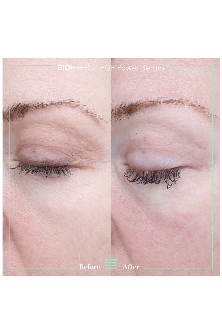EGF Power Serum, Alternate, color, NO COLOR