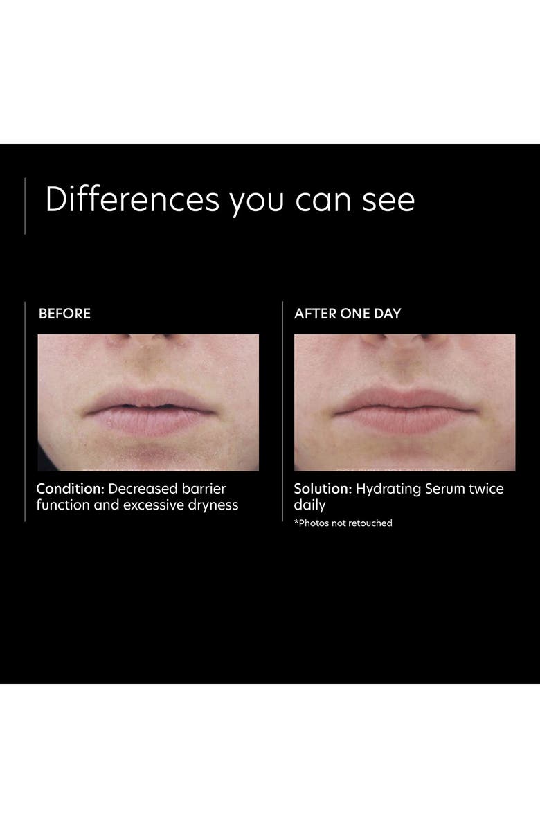 PCA Skin Hydrating Serum, Alternate, color,