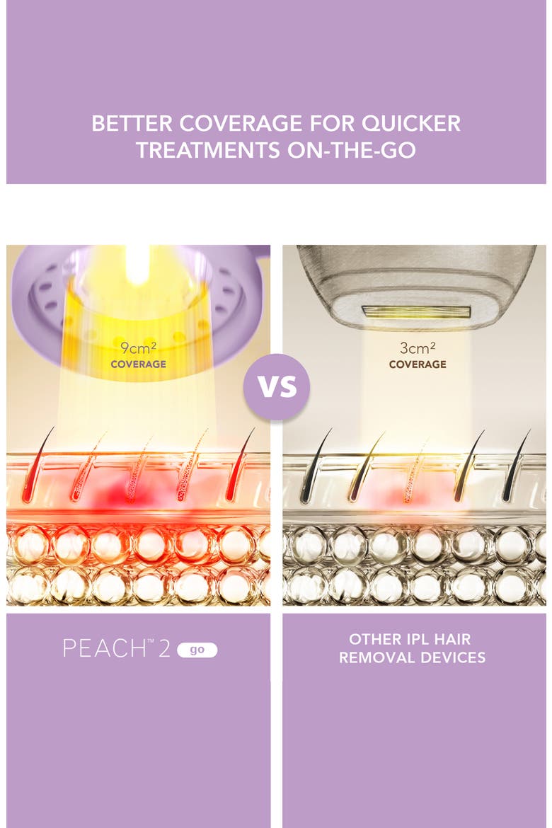 PEACH 2 Go Advanced Hair Removal Device, Alternate, color, LAVENDER