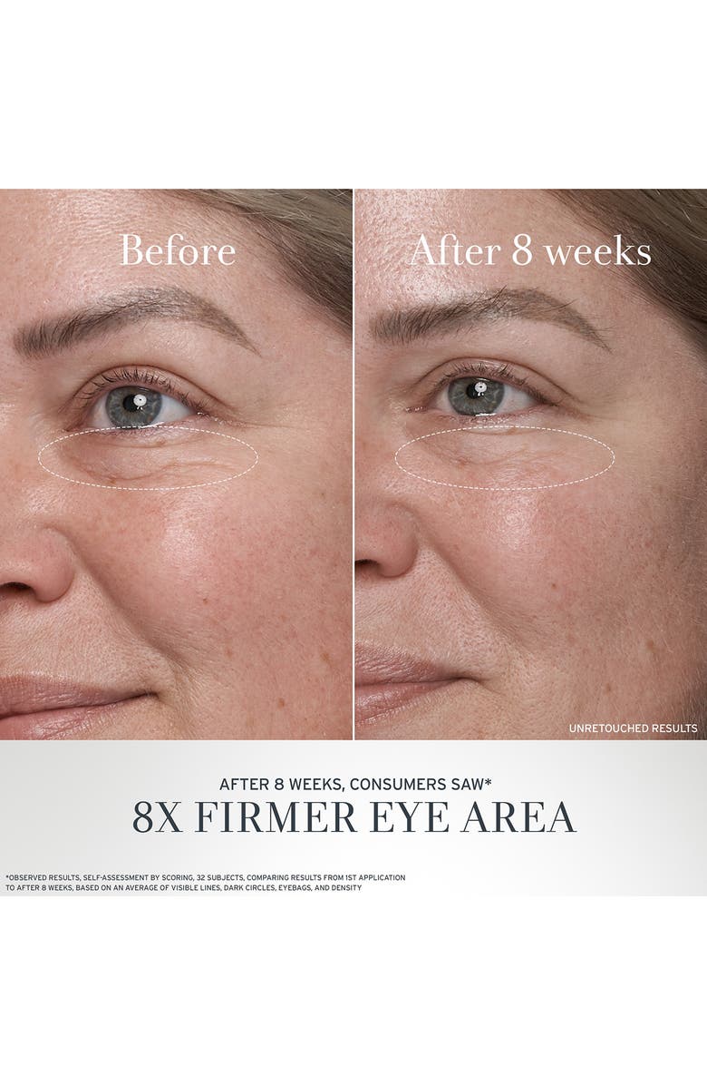 Fresh<sup>®</sup> Black Tea Age Renewal Eye Duo (Limited Edition) (Nordstrom Exclusive) $144 Value, Alternate, color,