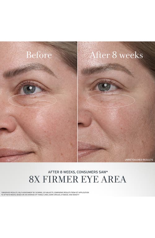 Fresh ® Black Tea Age Renewal Eye Duo (limited Edition) (nordstrom Exclusive) $144 Value In No Color