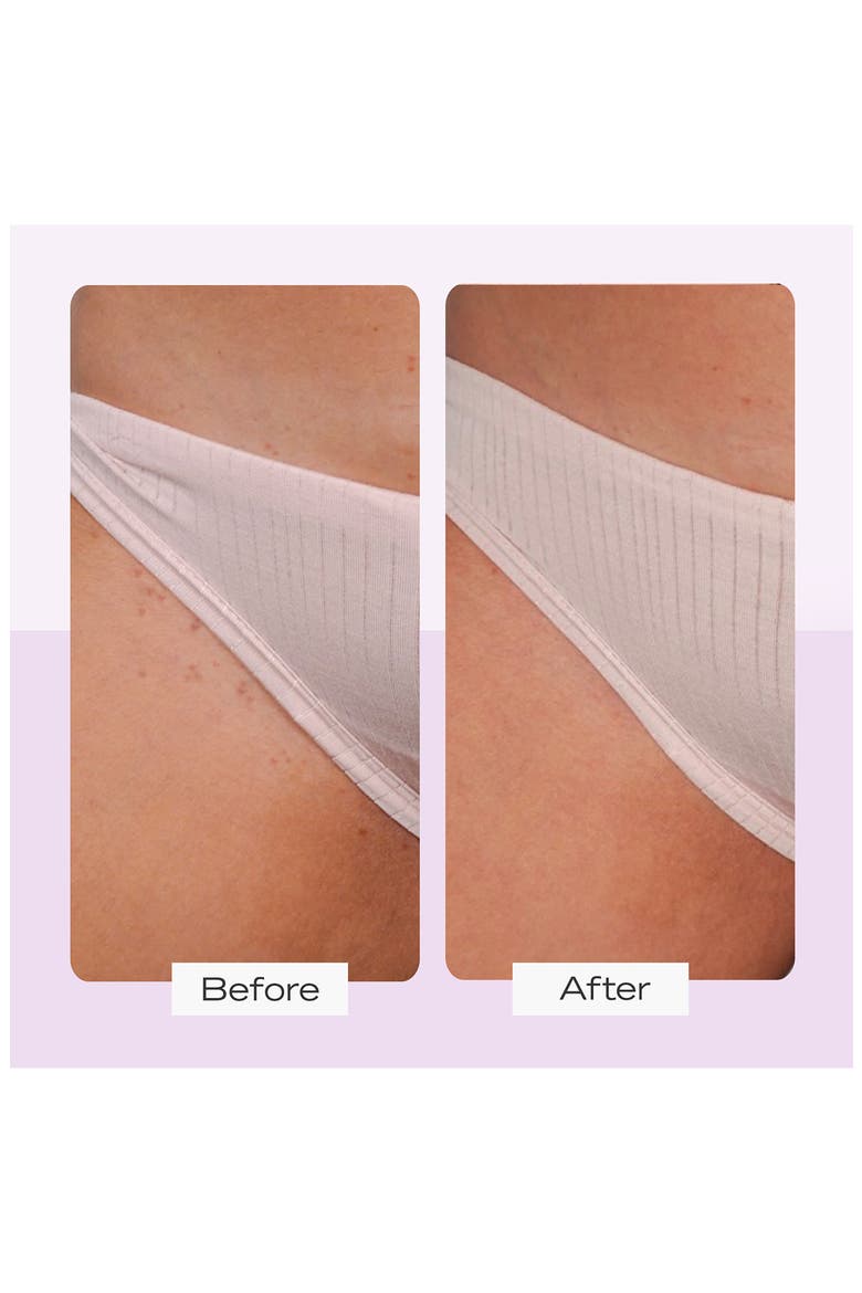 Ingrown Hair Pads with BHA & AHA, Alternate, color, NO COLOR