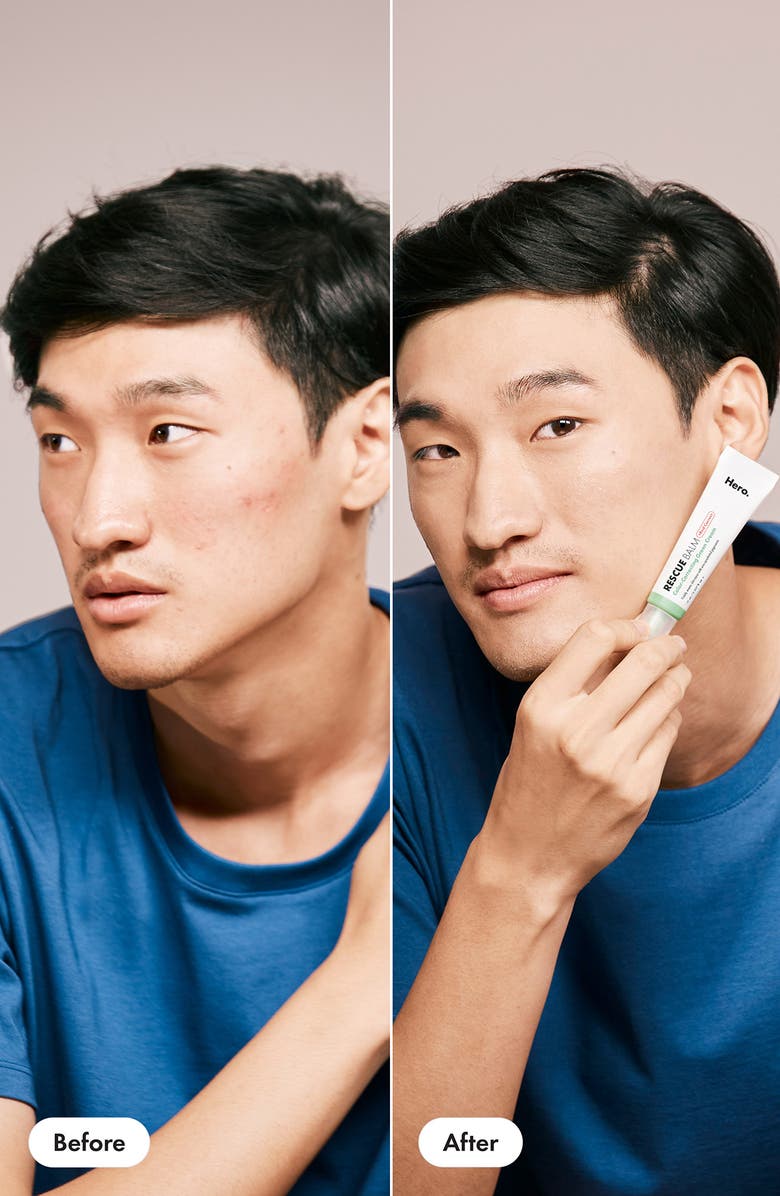 Hero Rescue Balm +Red Correct, Alternate, color,