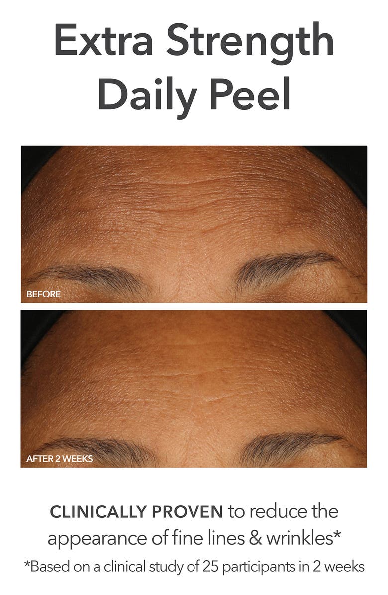 Dr. Dennis Gross Skincare Faceware Pro Set $568 Value, Alternate, color,