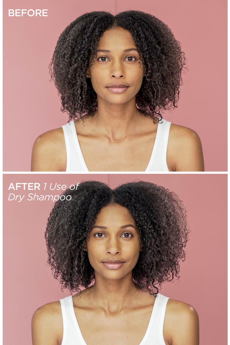 Healthy Scalp Dry Shampoo, Alternate, color, NO COLOR