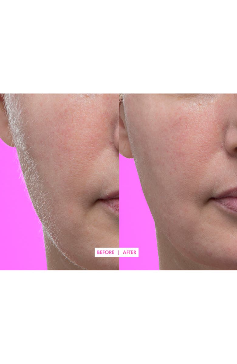 DERMAFLASH Lavender Facial Exfoliating Device, Alternate, color,