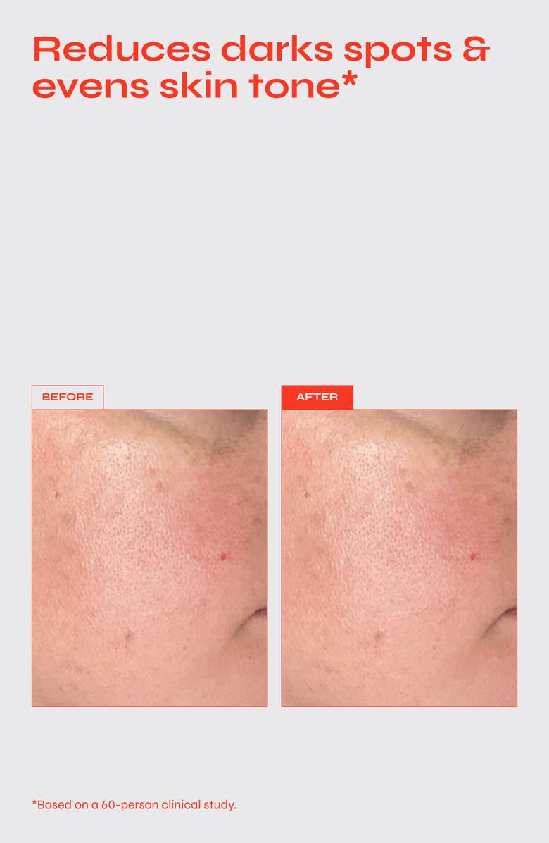 FACILE Brighten 5% Niacinamide Serum for Dark Spots & Uneven Texture, Alternate, color,