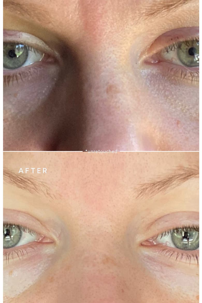 Deep Repair Eye Serum, Alternate, color, NO COLOR