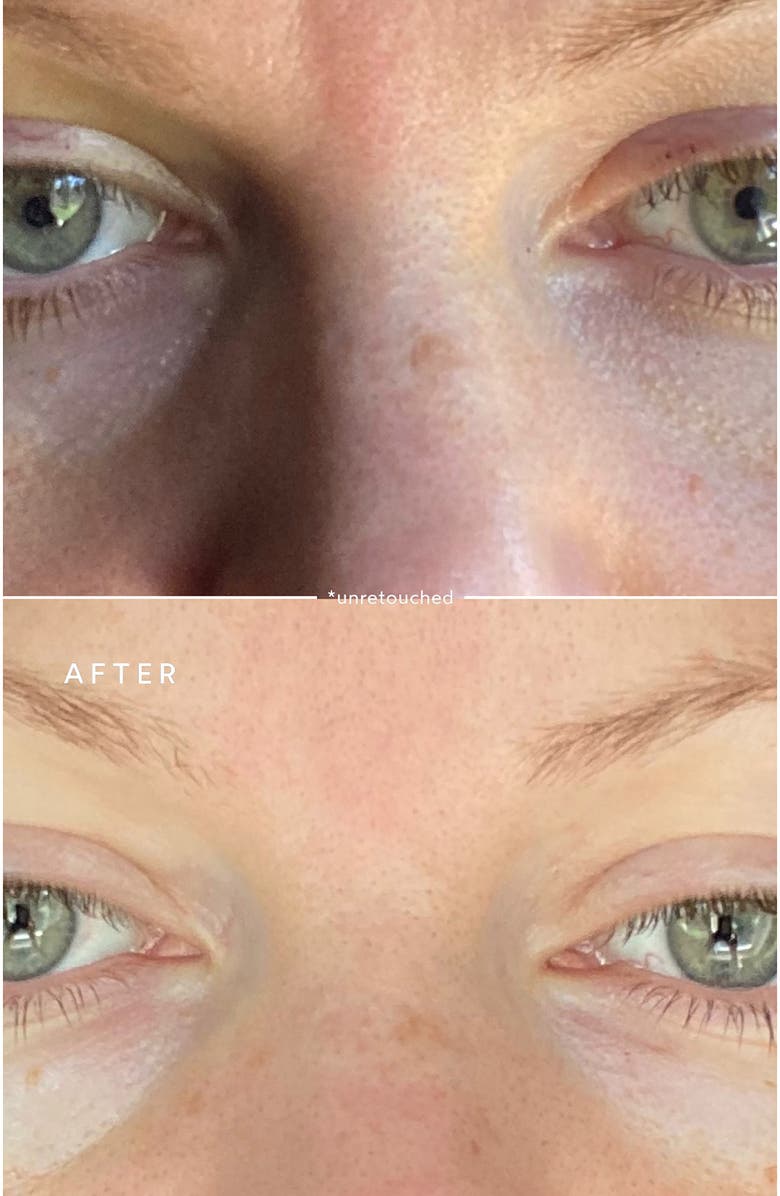 True Botanicals Deep Repair Eye Serum, Alternate, color, 