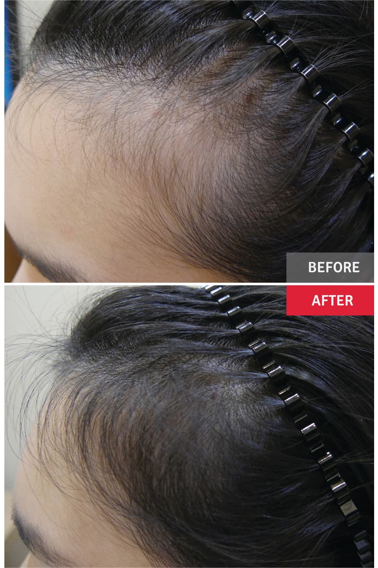Professional Hair Tonic & Powder, Alternate, color, NO COLOR
