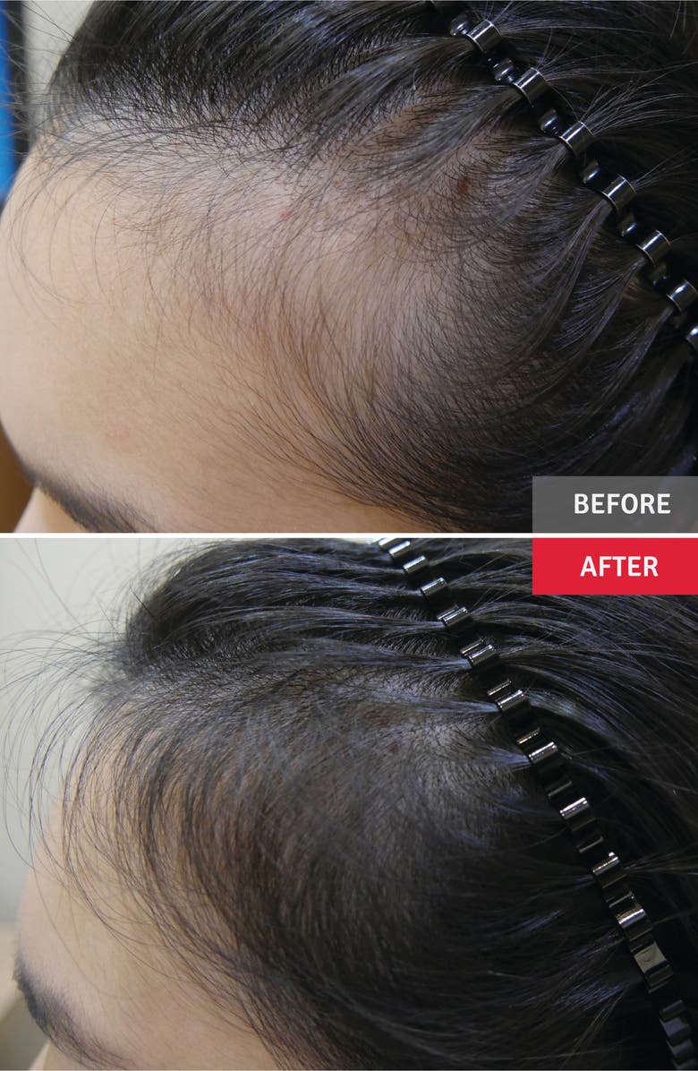 Vitabrid C12 Professional Hair Tonic & Powder, Alternate, color, 