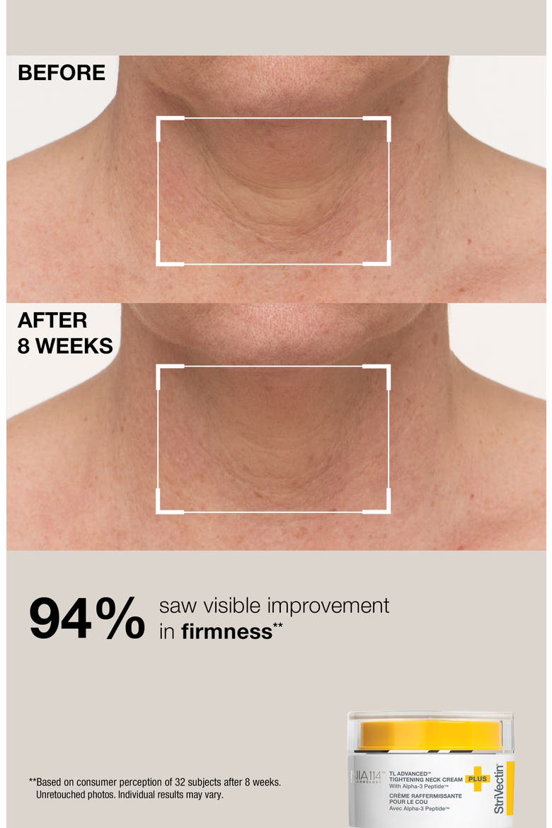 Tighten & Lift Neck Solutions Set, Alternate, color, NO COLOR