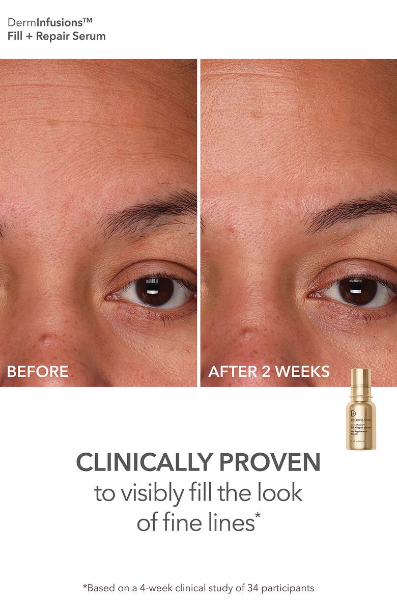 Dr. Dennis Gross Skincare Luminous Legends FaceWare Pro LED Device & Skin Care Essentials Set, Alternate, color, 