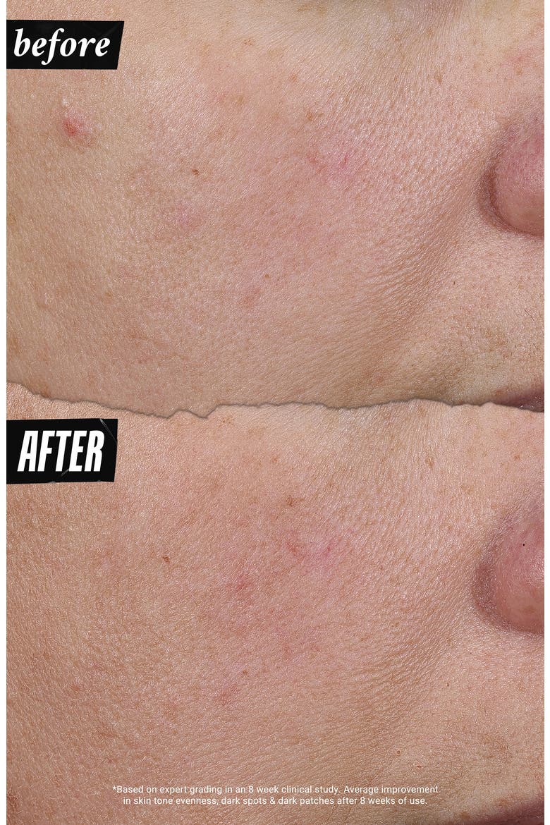 Auto-Tone Discoloration & UV Solution, Alternate, color, NO COLOR