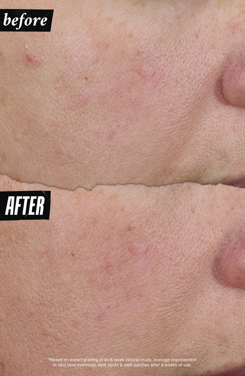 Kiehl's Since 1851 Auto-Tone Discoloration & UV Solution, Alternate, color,