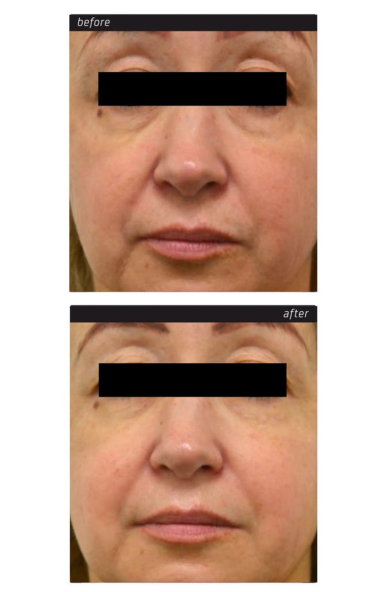 Blue Lagoon Iceland BL+ The Serum & BL+ The Eye Serum Set, Alternate, color, 