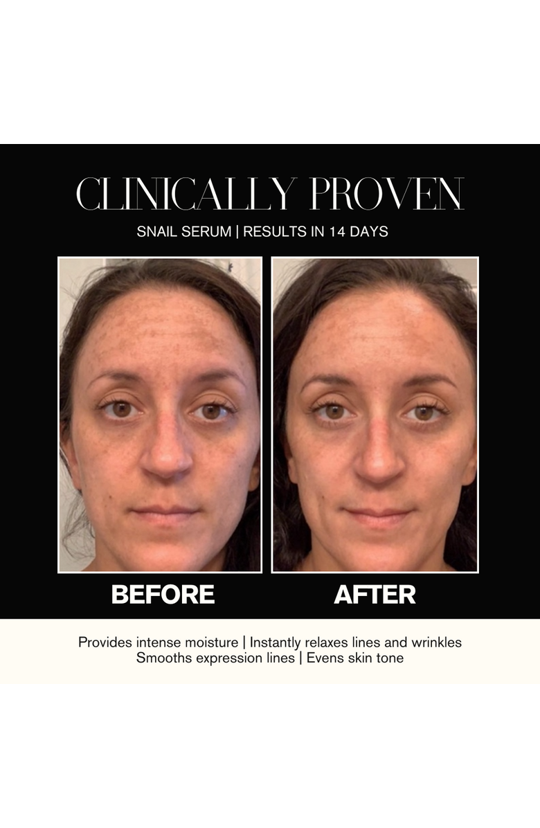 Intoxicated Cosmetics Snail Serum + Mini Snail Serum | Full Size 1 fl oz/ 30 ml
Travel Size 0.17oz/5ml |Hydrating
Anti-Aging Skincare Treatment with Vegan Snail Venom Peptide
Vegan Snail Mucin, Alternate, color, NO COLOR