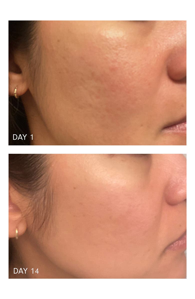 Rose Ingleton MD Signature Moisturizer with Peptides & Hyaluronic Acid, Alternate, color,