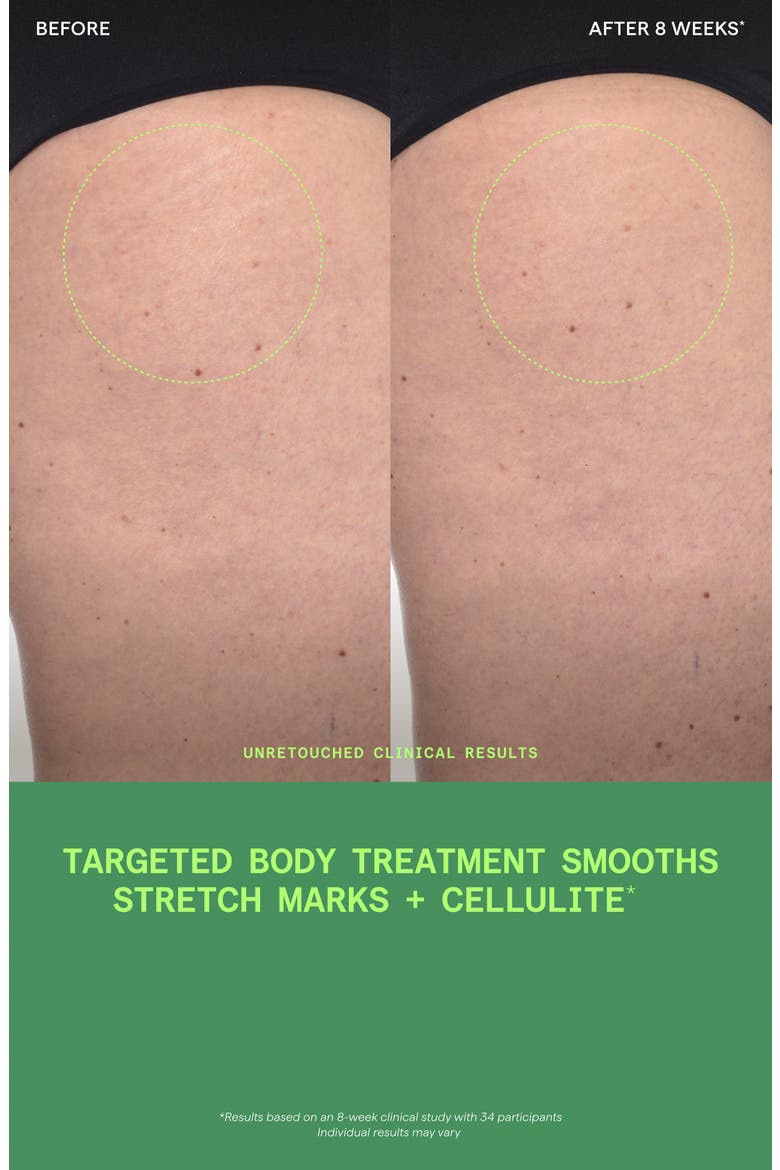 Retinal ReSculpt Body Treatment, Alternate, color, NO COLOR