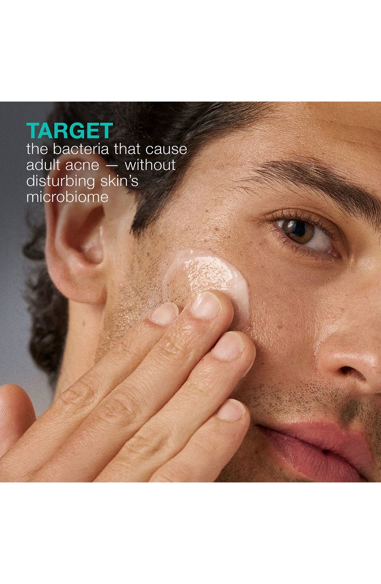 dermalogica<sup>®</sup> Acne Biotic Moisturizer, Alternate, color, 