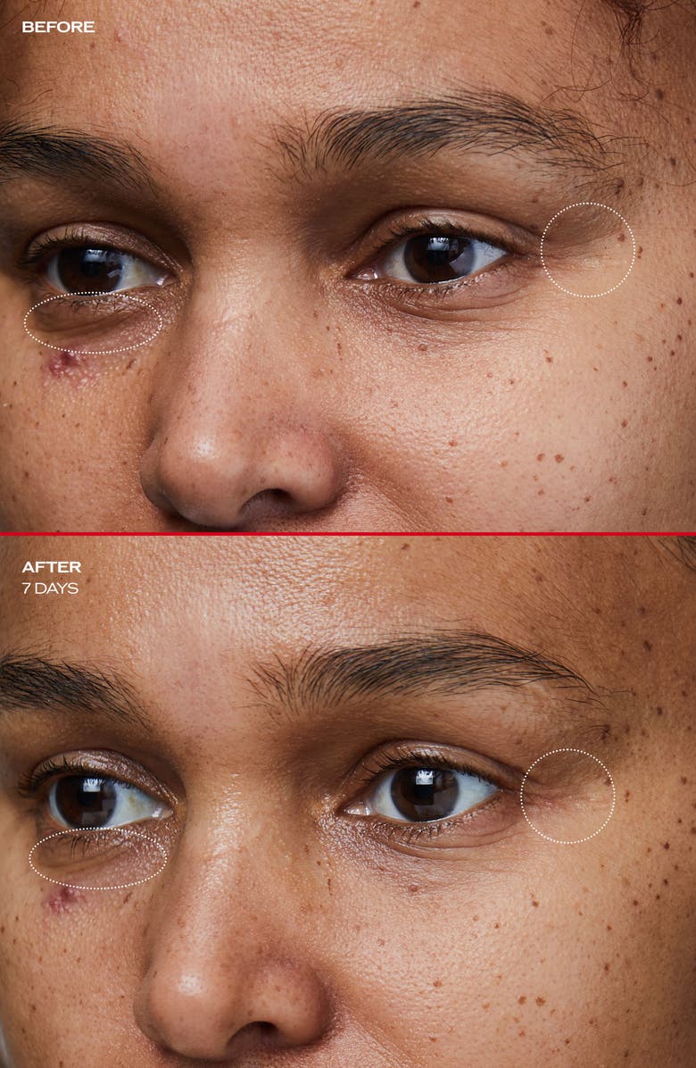 Shiseido Benefiance Wrinkle Smoothing Eye Cream, Alternate, color, 