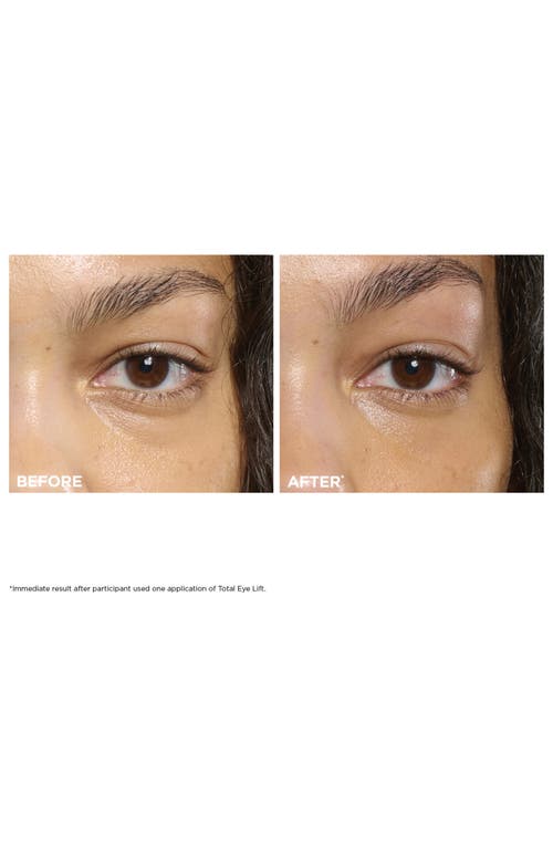 Clarins Totaly Eye Lift
