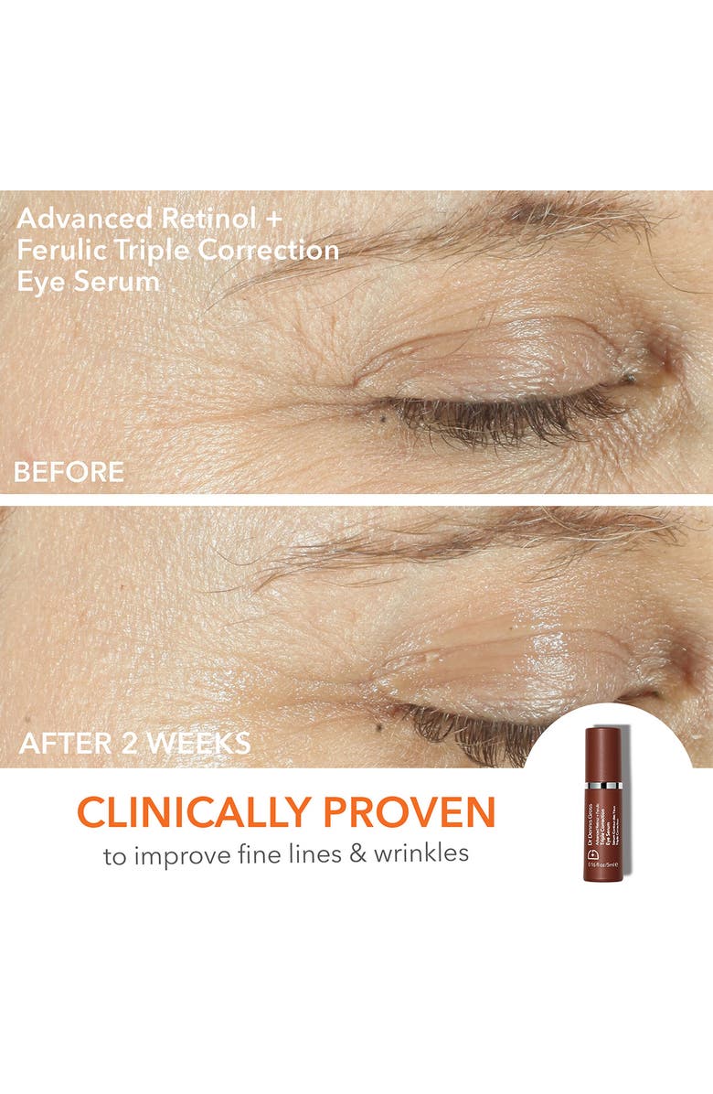 Dr. Dennis Gross Skincare Light It Up Faceware Bundle (Limited Edition) USD $598, Alternate, color, 