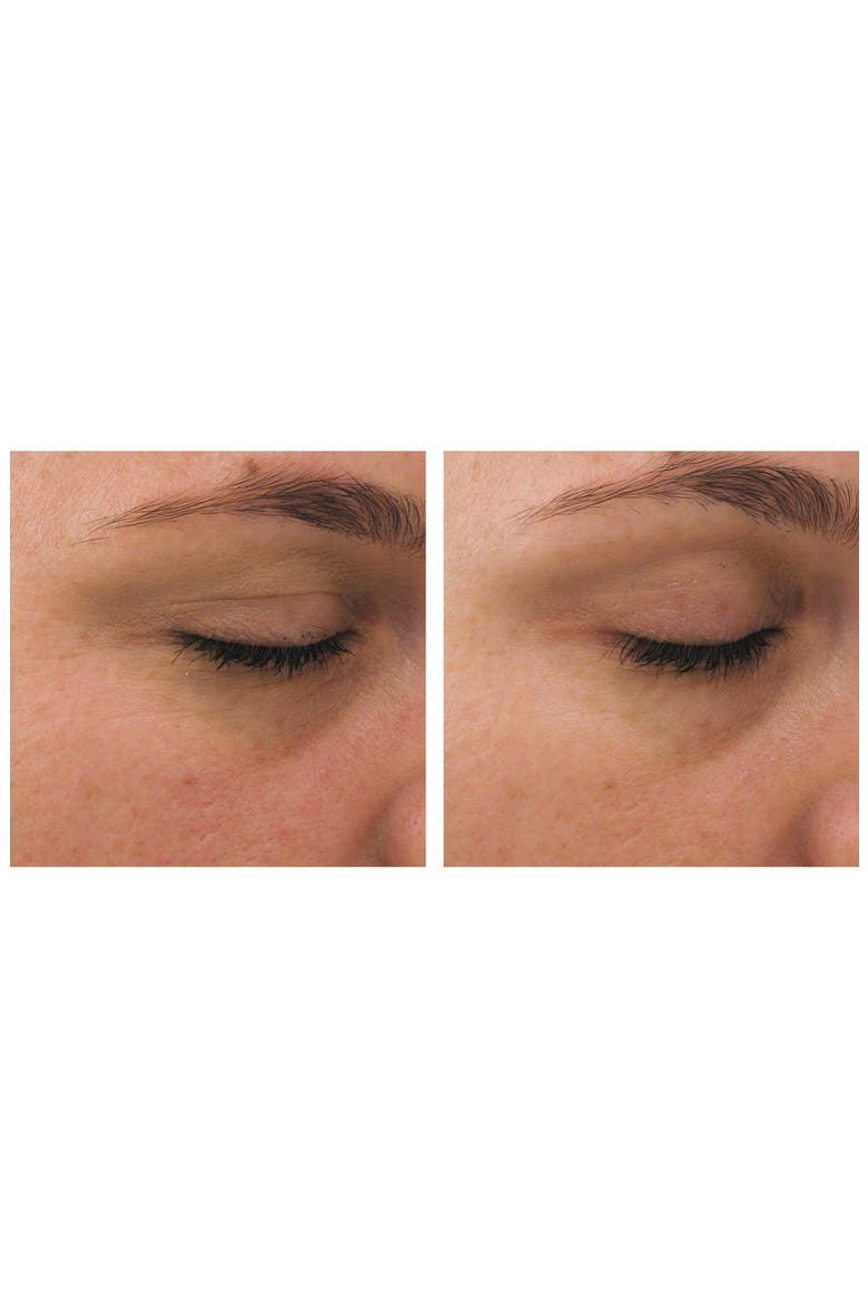 Ideal Complex Restorative Eye Cream, Alternate, color, NO COLOR