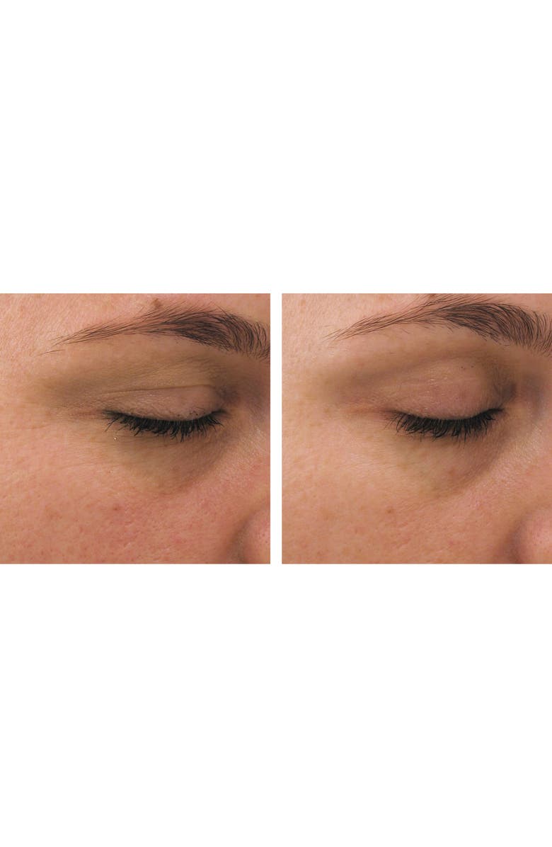 PCA Skin Ideal Complex Restorative Eye Cream, Alternate, color,