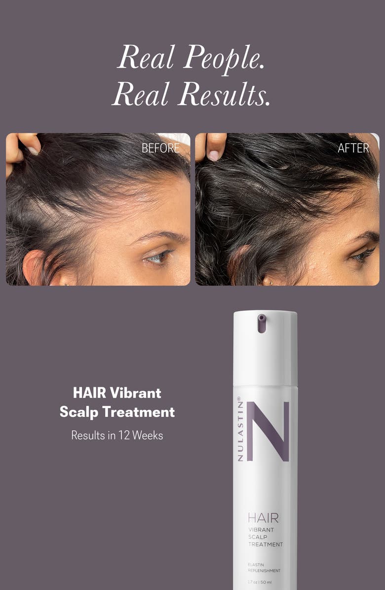 NULASTIN Vibrant Scalp System, Alternate, color, White Brilliant
