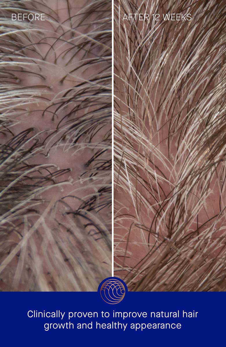 Augustinus Bader The Conditioner, Alternate, color,