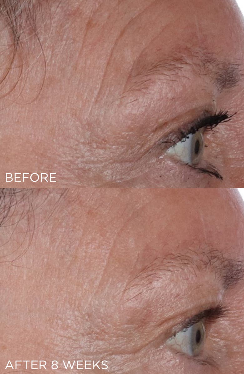 Perricone MD Cold Plasma Plus+ The Essence, Alternate, color, 