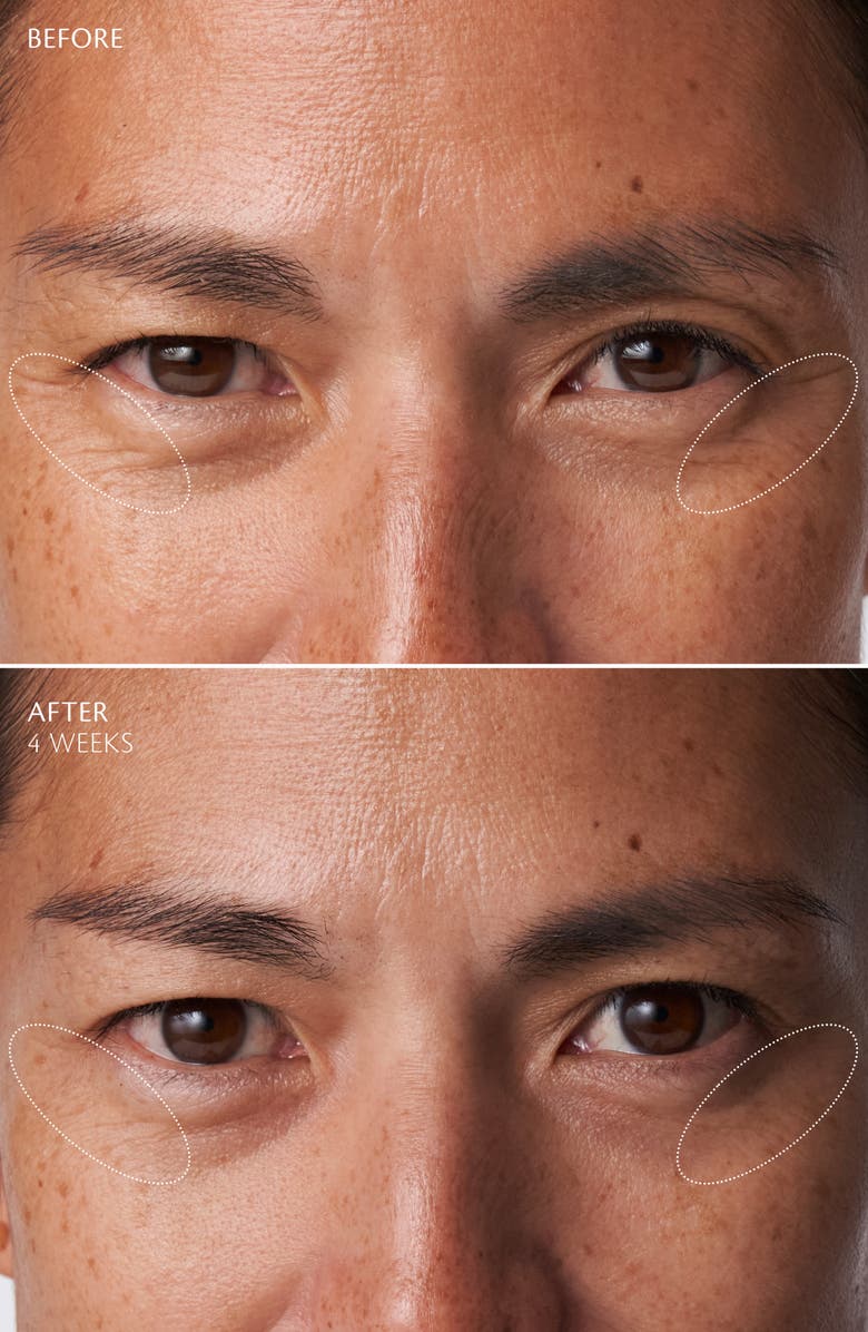 Clé de Peau Beauté Eye Contour Cream Supreme, Alternate, color, Regular