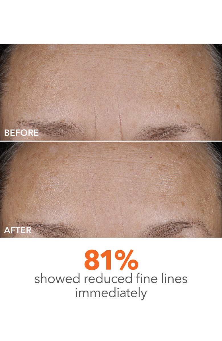 Dr. Dennis Gross Skincare DermInfusions Blur + Repair Cream, Alternate, color, Regular