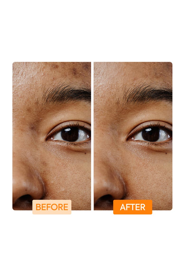 Vitamin C & Turmeric Facial Cleaning Bar, Alternate, color, None