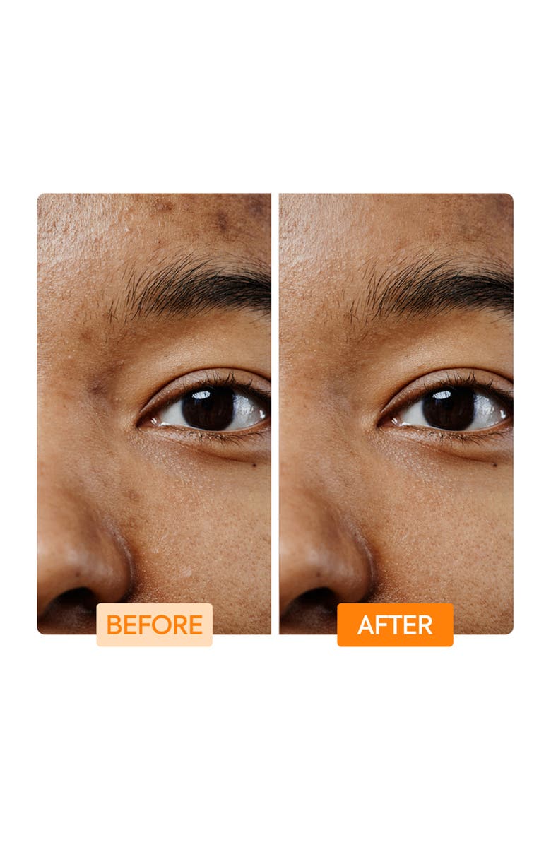 Makari de Suisse Vitamin C & Turmeric Facial Cleaning Bar, Alternate, color, NO COLOR