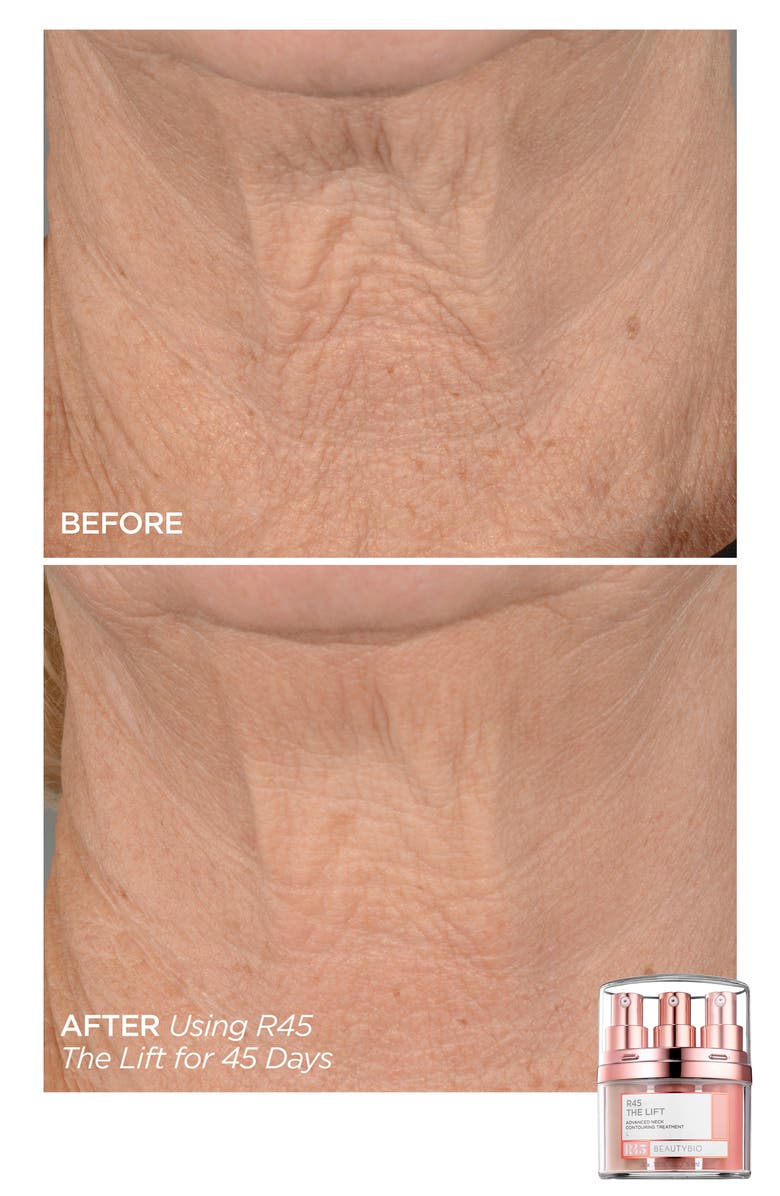 BeautyBio Full Size R45 The Reversal 3-Phase Skin Transforming Treatment Set $235 Value, Alternate, color,