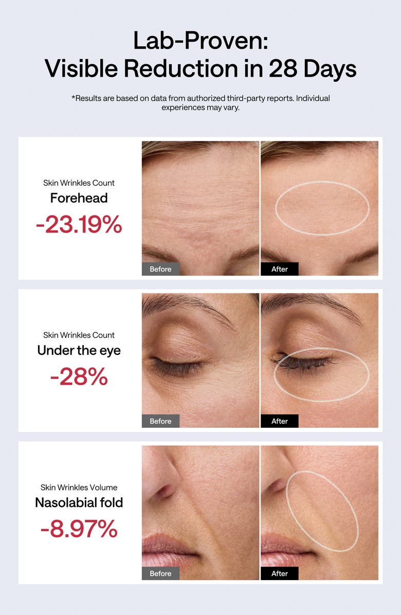JMOON UCollagen+ Portable Beauty Device Set $499 Value