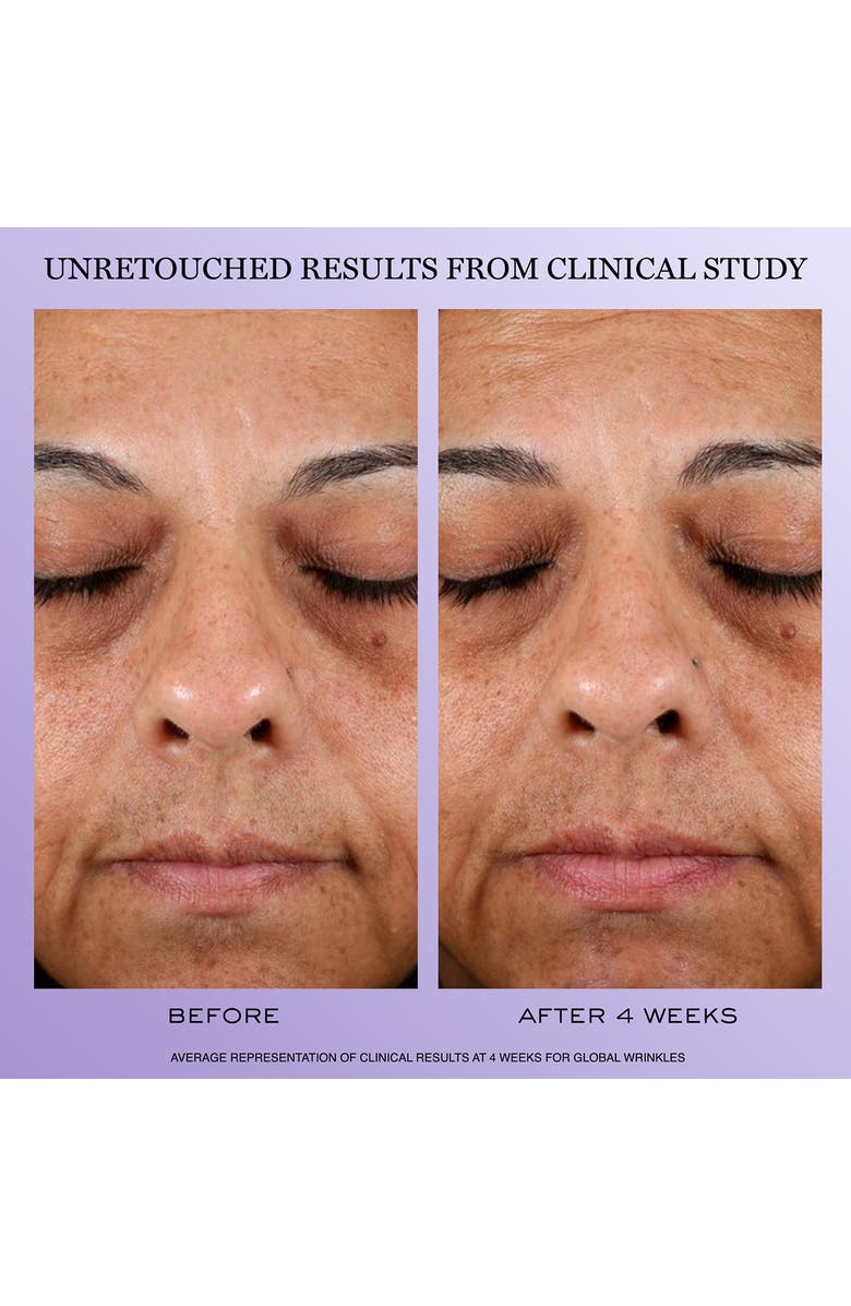 Lancôme Rénergie Mother's Day Skin Care Set $277 Value, Alternate, color, 