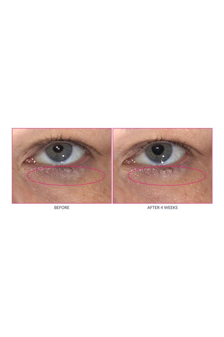 Wrinkle Warrior Eye Gel Visible Dark Circle Eraser, Alternate, color, NO COLOR