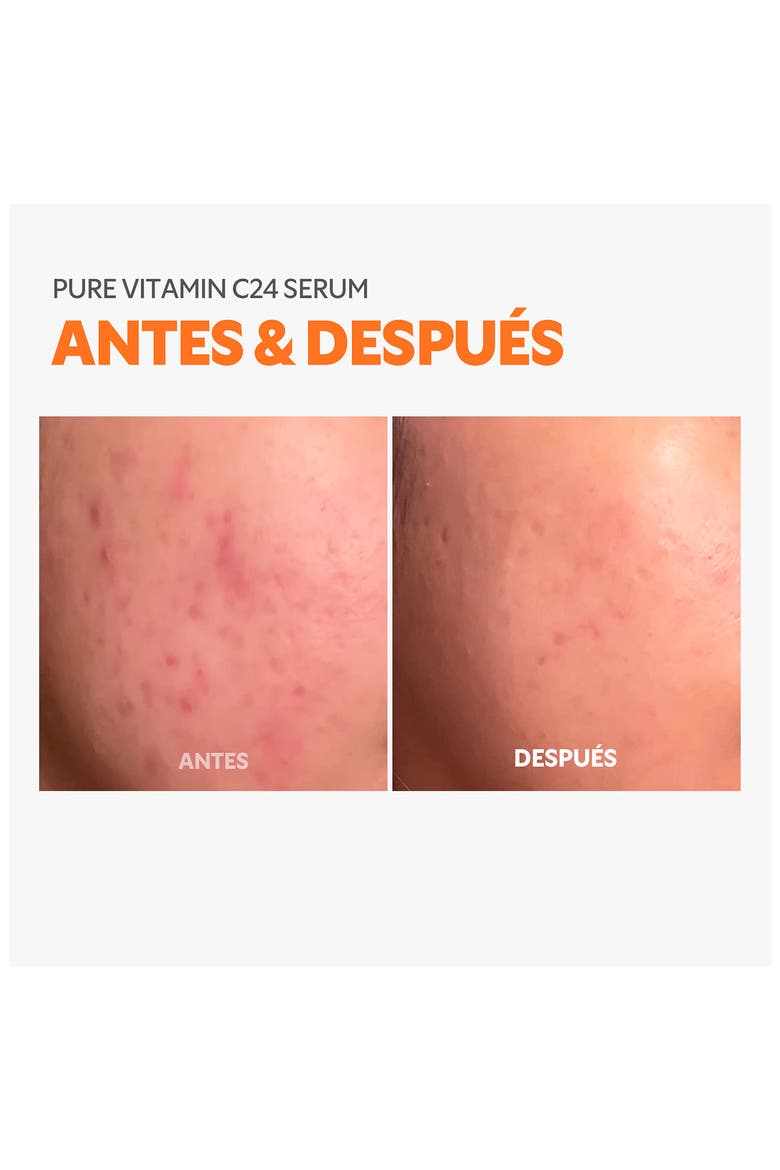 Pure Vitamin C24 Serum, Alternate, color, WHITE
