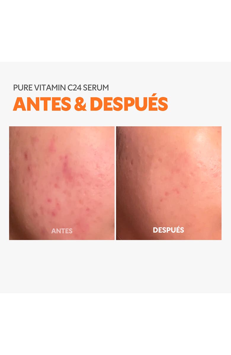 TIRTIR Pure Vitamin C24 Serum, Alternate, color, White