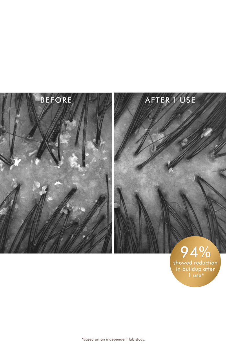 MOROCCANOIL<sup>®</sup> Purifying Pre-Wash Scalp Scrub, Alternate, color,